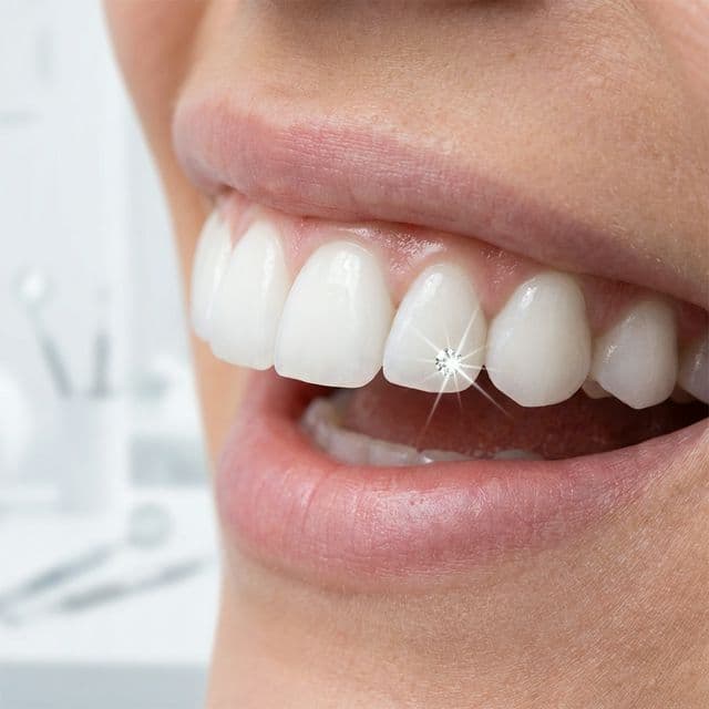 Teeth Whitening & Tooth Jewellery